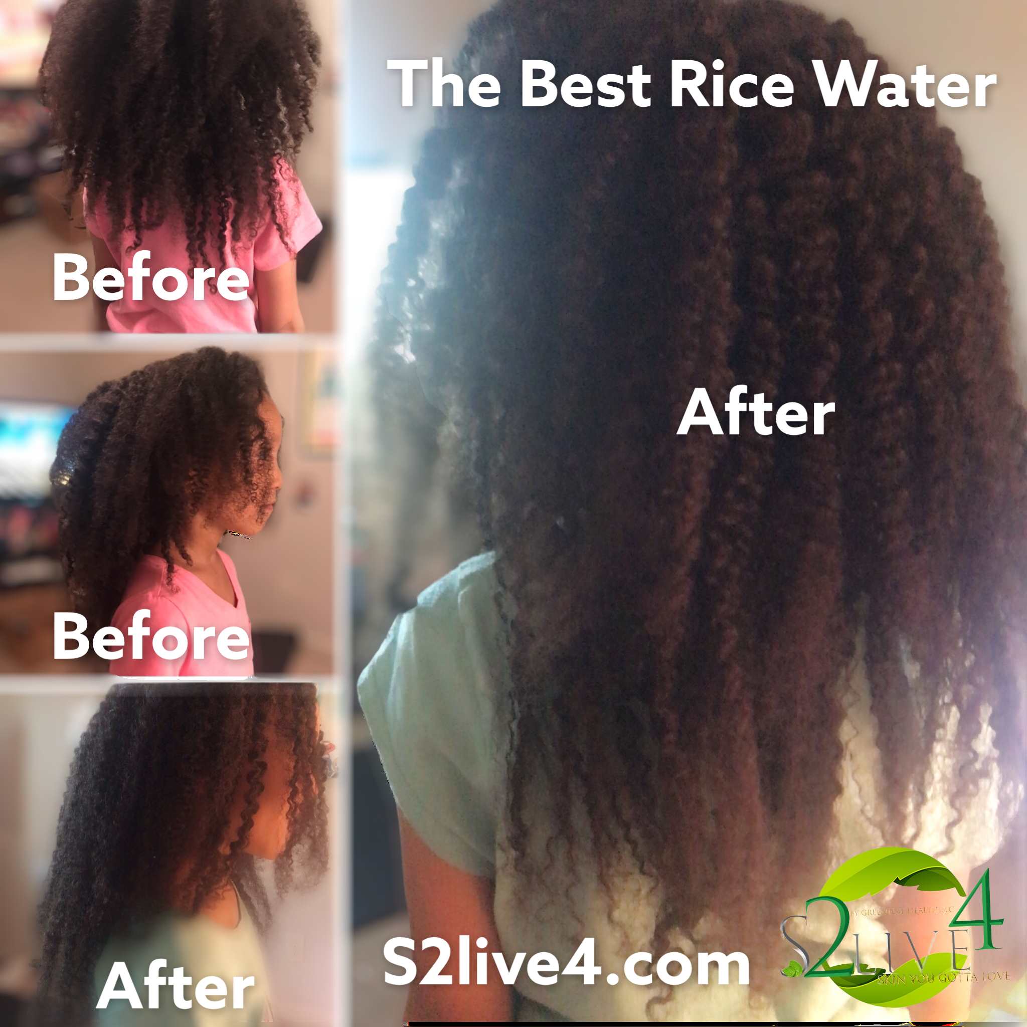 Rice & Herb Water for extreme hair growth – Skin2Live4